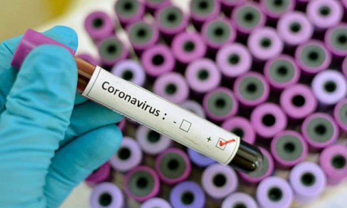 U Hrvatskoj 459 lažnih PCR testova kod onih koji su u RH ušli iz BiH